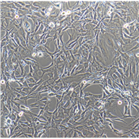 HCC1500人乳腺導管癌細胞