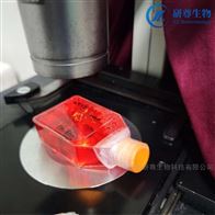 �ѱ���97���˸�ת���Ըΰ�ϸ��