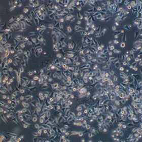 人胃癌細(xì)胞SNU601(STR鑒定正確)