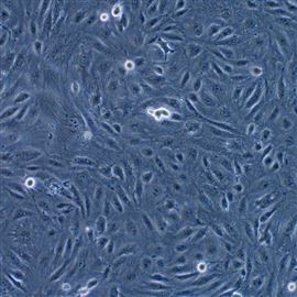 人膀胱癌細胞SW1710 (STR鑒定正確)