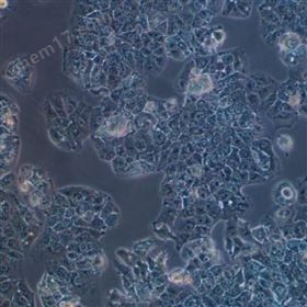 人肝癌細胞HuH-1(STR鑒定正確)