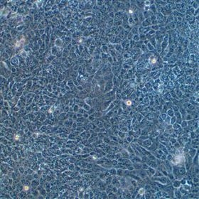 人舌鱗狀癌細胞SAS(STR鑒定正確)