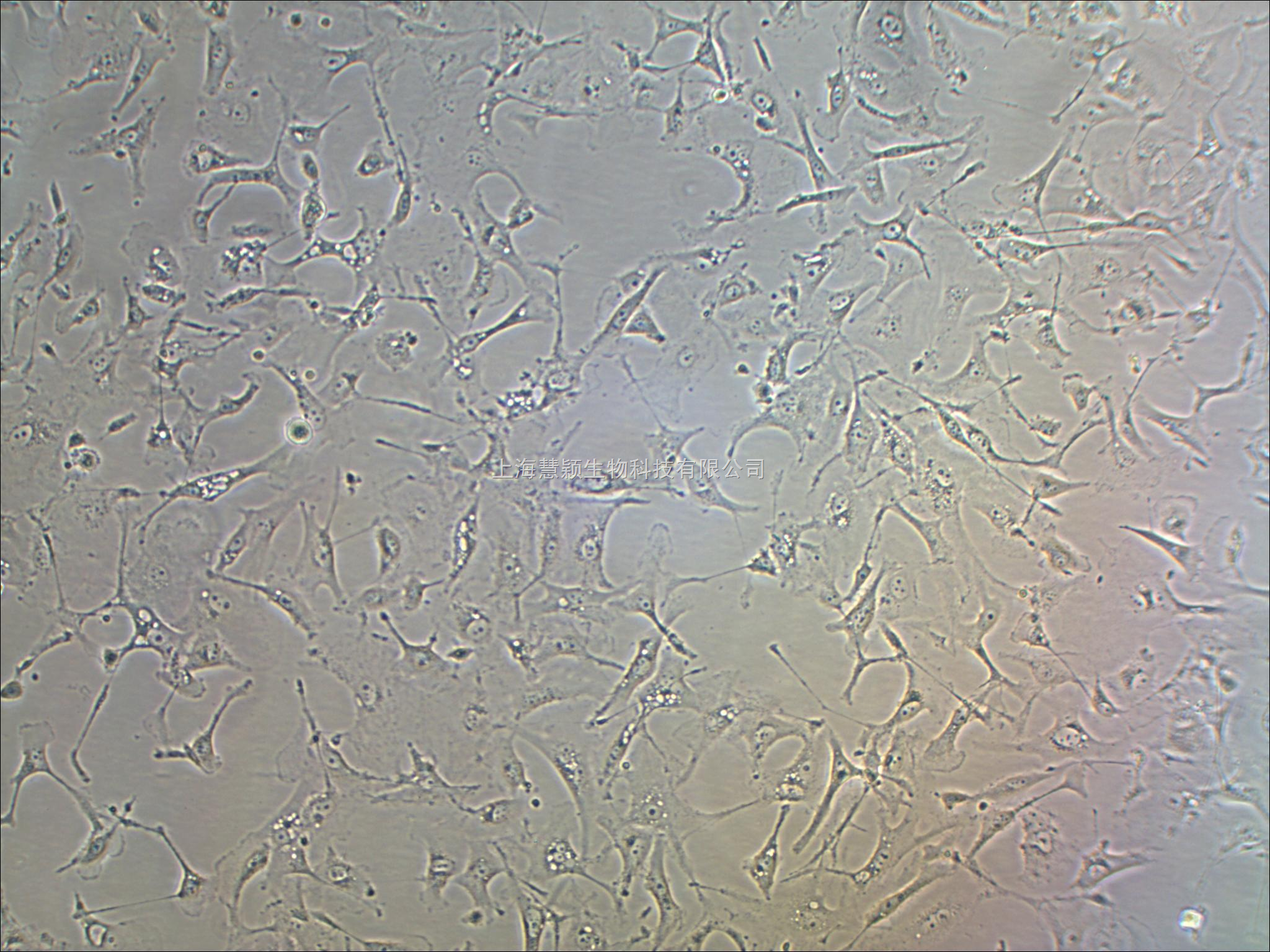 huvec人脐静脉血管内皮细胞株