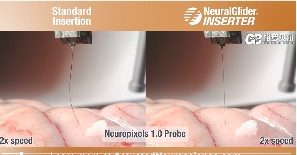 格羅貝爾引入超聲黑科技：助力電極精準植入與長效穩定
