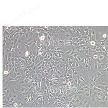 人臍靜脈成纖維細(xì)胞系