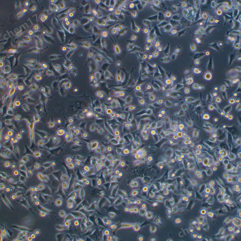 人胃癌細(xì)胞SNU601(STR鑒定正確)