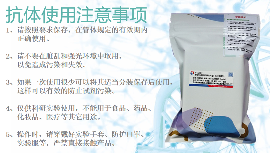 小鼠抗人IgA单克隆抗体 高特异性抗体