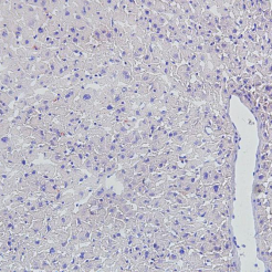 G1261-Oil Red-Paraffin.png