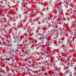 G1261-Oil Red-OCT.png