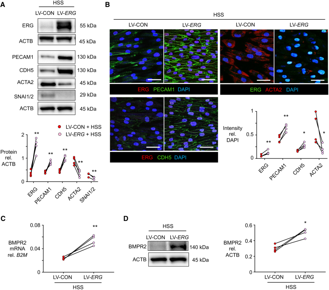 高剪切应力降低 ERG，导致内皮细胞间充质转化和肺动脉高压