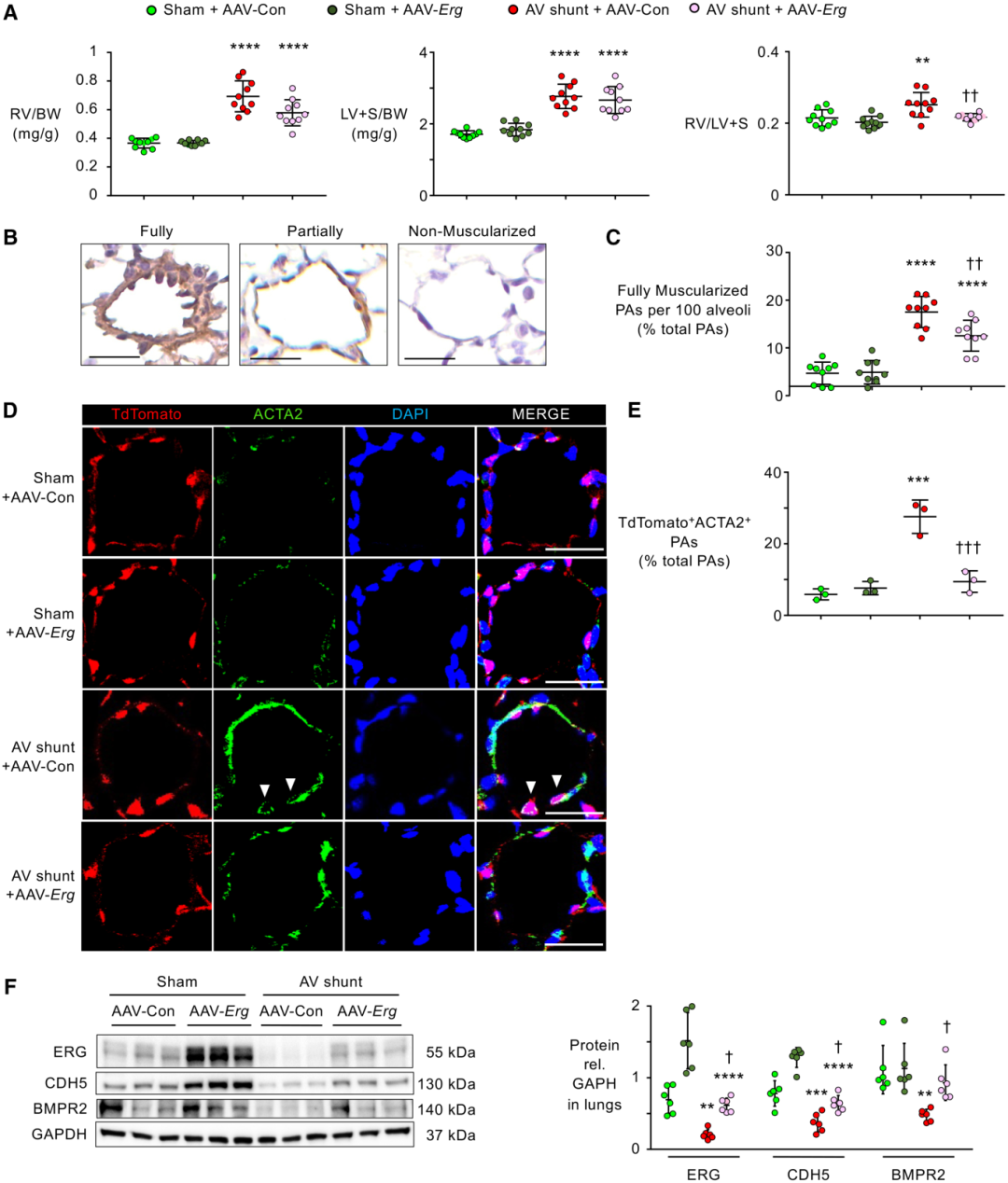 高剪切应力降低 ERG，导致内皮细胞间充质转化和肺动脉高压