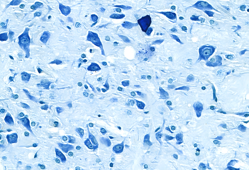 產(chǎn)品星推薦|多場景適用！甲-苯胺藍的多元功能