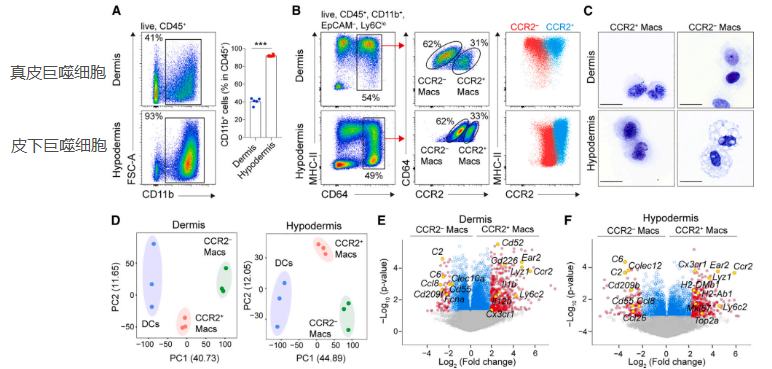 皮膚巨噬細(xì)胞的分類(lèi)和功能